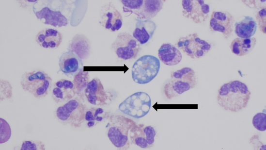Brain Eating Amoeba
