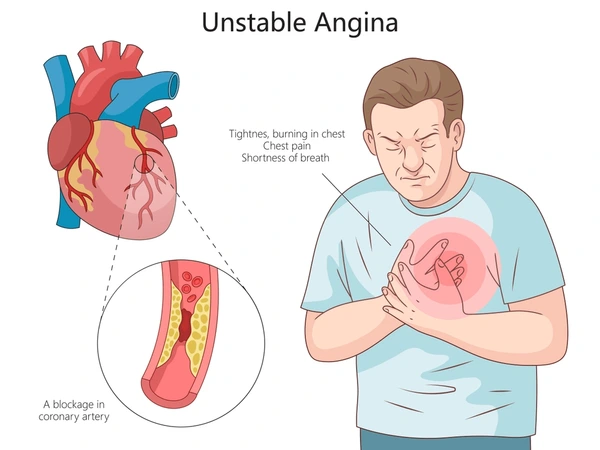 Heart Disease Symptoms